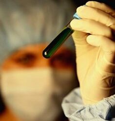 hoe u zich kunt laten testen op parasieten