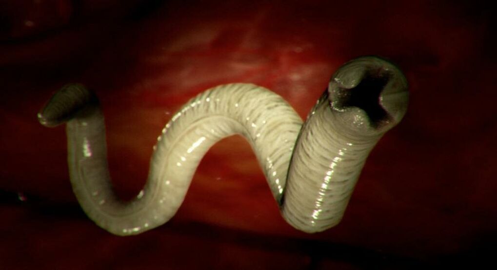 worm uit het menselijk lichaam
