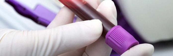 bloed voor testen op parasieten