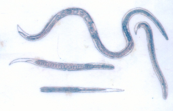 De Guineaworm, die onder de huid parasiteert, raakt gemakkelijk besmet