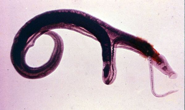 Schistosomen zijn een van de meest voorkomende en gevaarlijke parasieten